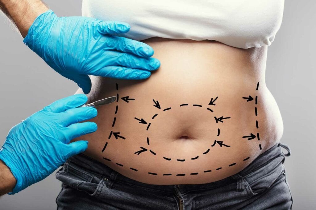 Chirurgie esthétique à Lille et Arras - Dr FrédéricLaurent