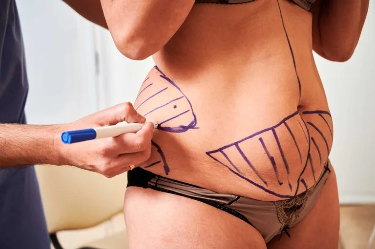 Chirurgie du ventre à Lille et Arras
