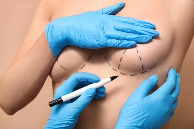À partir de quel âge peut-on envisager un lipofilling mammaire ?